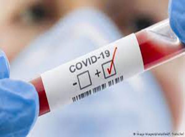 Славутич: стан захворюваності на COVID-19 фото