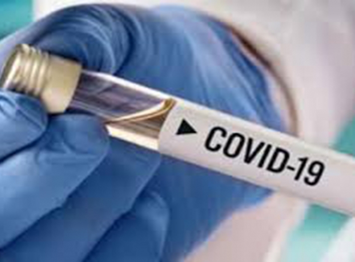 315 лабораторно підтверджених випадки COVID-19 виявили у Славутичі за добу фото