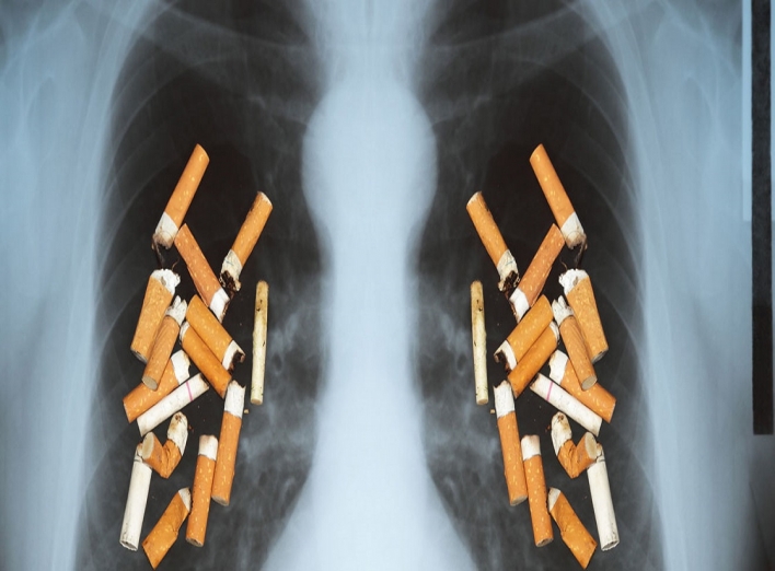Як очистити легені від нікотину: фахівці поділилися дієвими порадами