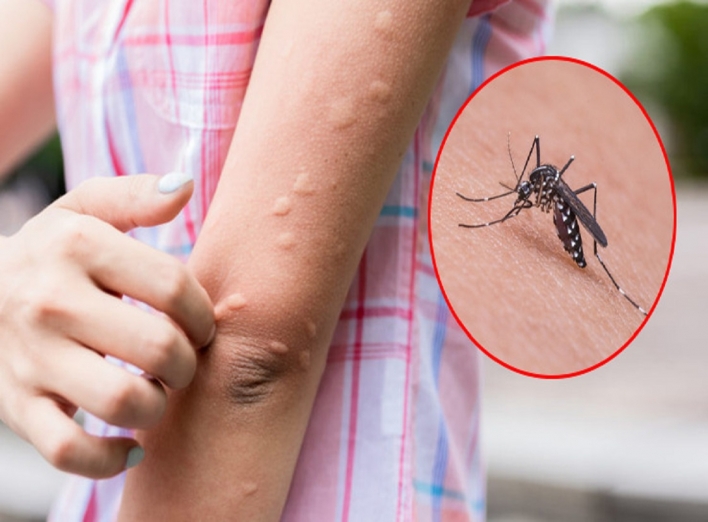 Побризкайте штори цим розчином: ні один комар не залетить в будинок за все літо