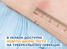 Нові тести на туберкульоз в Україні: кому варто пройти обстеження