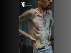 Проєкт “Хочу жити” показав фото Захисника ЧАЕС, славутичанина Романа Горілика після двох років у російському полоні