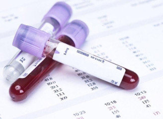 Новий аналіз крові дозволяє виявити рак ще до появи симптомів