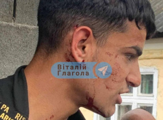 На Закарпатті стався збройний конфлікт між прикордонниками та представниками ромської громади: є постраждалі