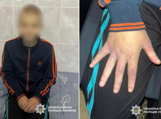 На Черкащині поліція вилучила 13-річного хлопчика з родини через систематичне насильство фото