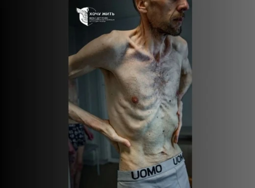 Проєкт “Хочу жити” показав фото Захисника ЧАЕС, славутичанина Романа Горілика після двох років у російському полоні фото