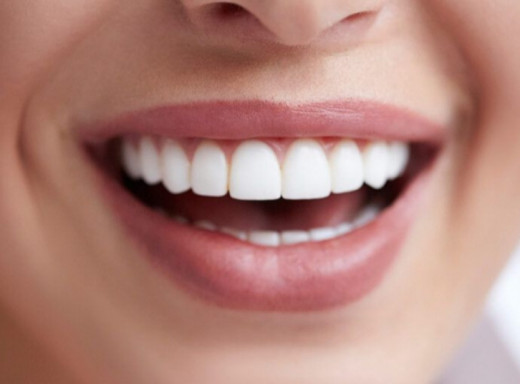 Вчені створили гель, який відновлює зубну емаль і може замінити пломби фото