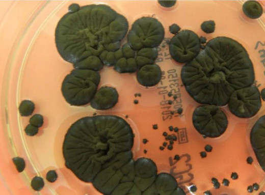 На території ЧАЕС виявили грибок, що перетворює радіацію на енергію фото