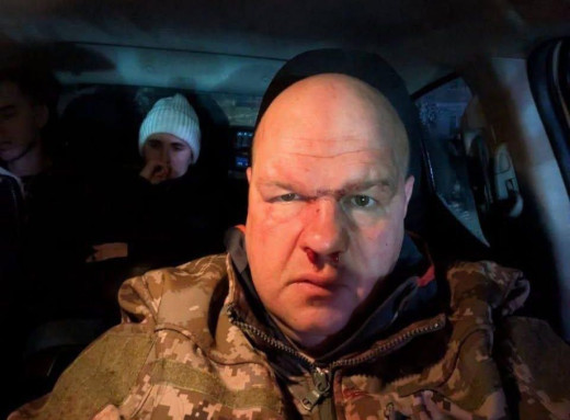 На Тернопільщині офіцера ЗСУ побили після ДТП з квадроциклами, дружина заявила про тиск через ТЦК фото